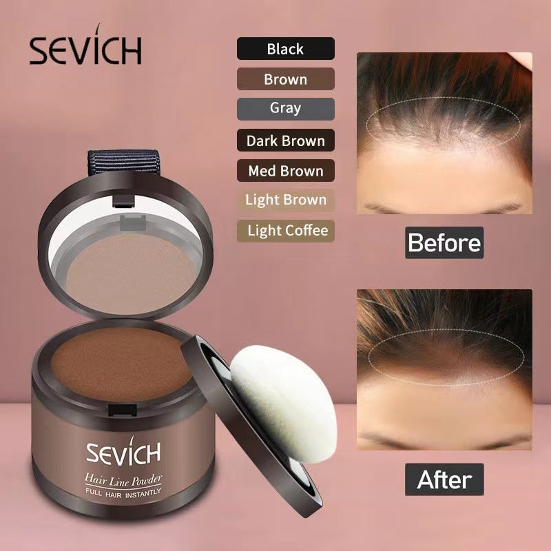 Forehead Sparse Hair Concealment and Contouring Hairline Filler