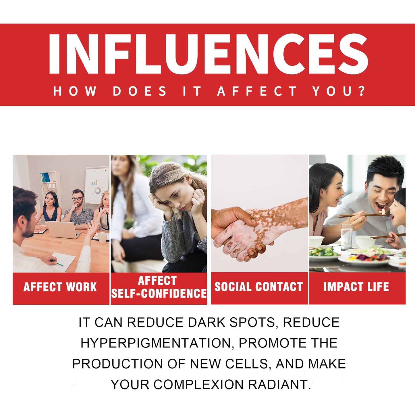 Dark Spot Whitening Cream, Lightening Yellow Brown White Spot Cream Dark Spots Correct Skin Tone Moisturize Skin Whitening