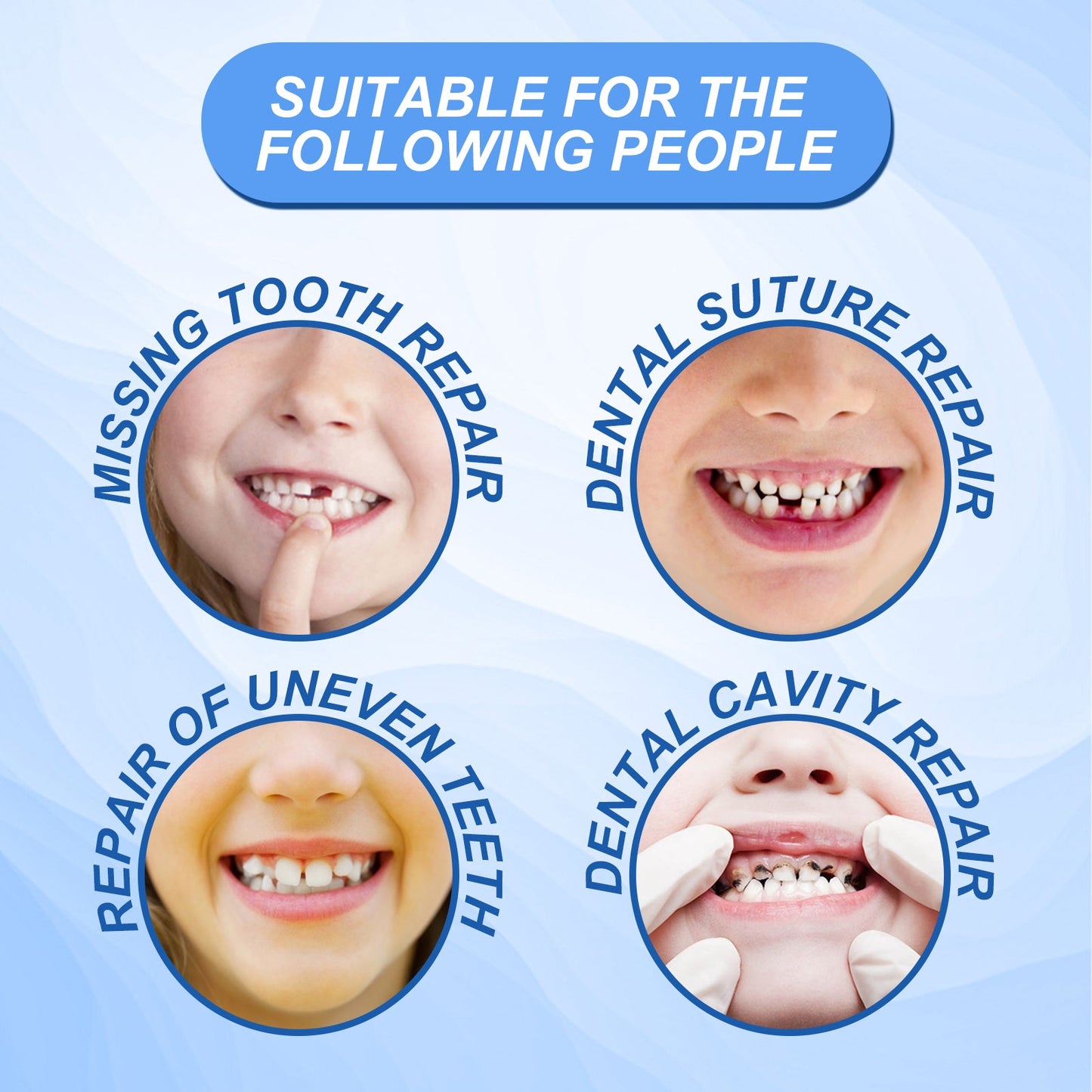 Solid Dental Glue Modification Teeth Temporary Filling Holes Filling Glue Prosthetic Dental Glue