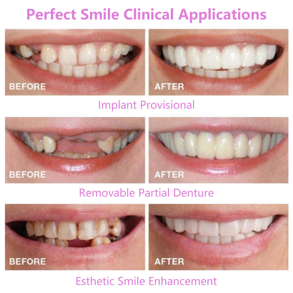 Upper Teeth And Lower Teeth Simulation Braces Non-Porous Braces Whitening Sleeves Second-Generation Silicone Simulation Teeth Dentures