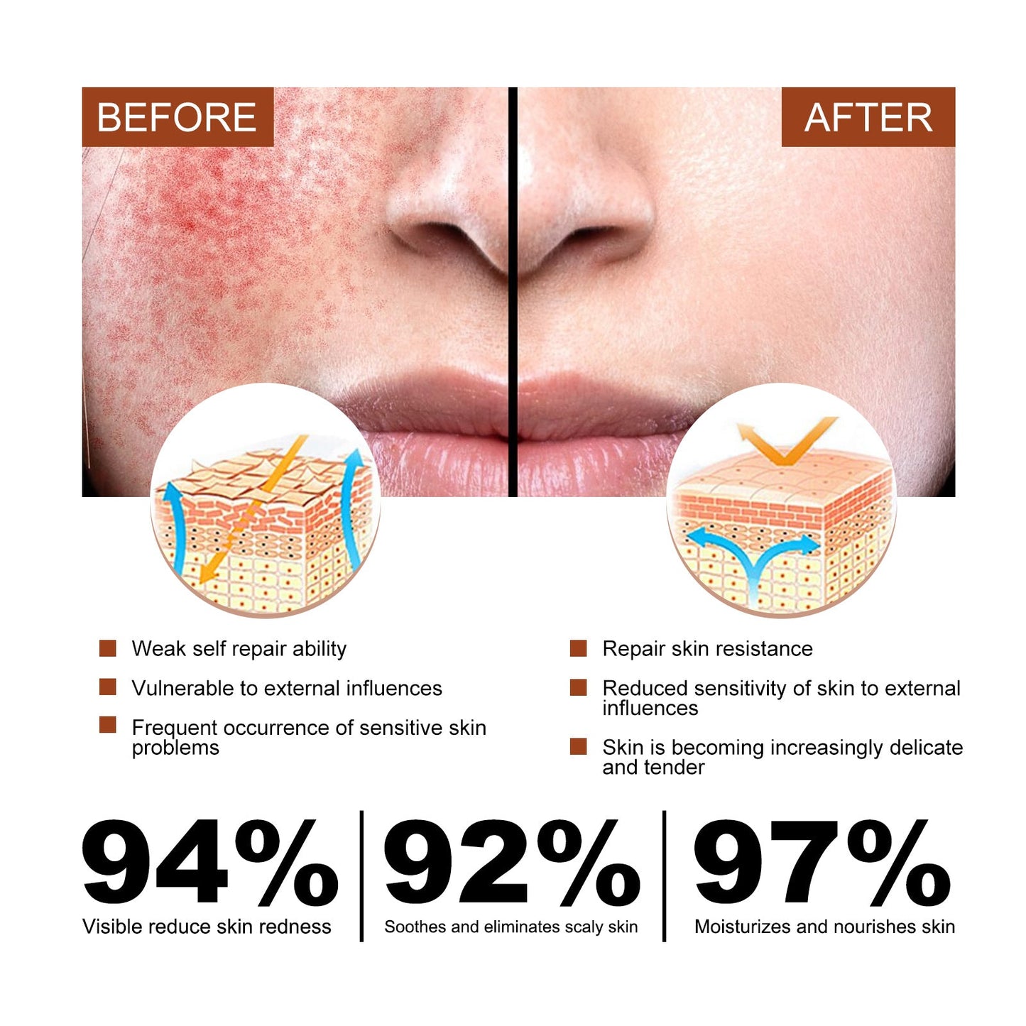 Erythematous Repair Essence, Repair Skin Lighten Facial Erythematous Moisturizing Essential Oil
