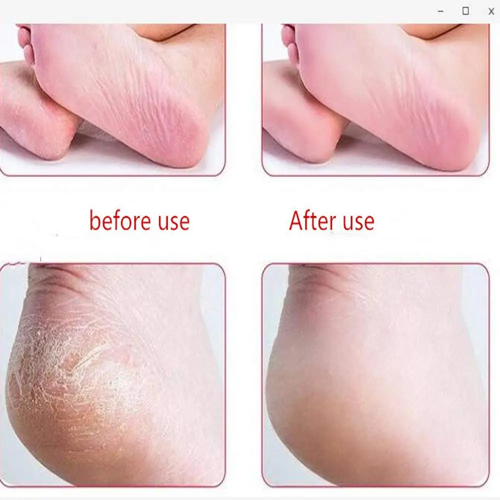 Foot Rasp File And Callus Remover Double Side Scrubs Scrubber Foot Care Pedicure Metal Surface Tool Remove Hard Skin