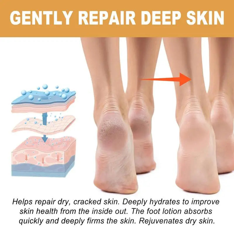 30ml Foot Callus Remover Spray Quickly Soften Calluses Exfoliation Dry Feet Skin Hydrating Foot Dead Skin Spray Foot Care
