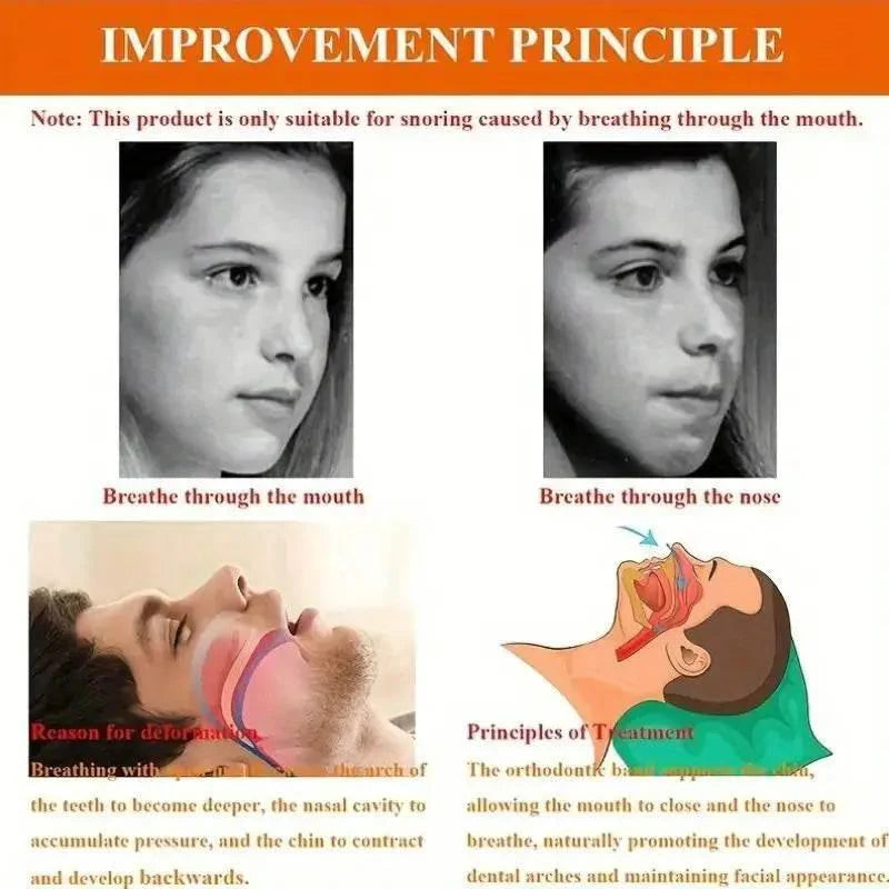 Anti-snoring Band Open Mouth Breathing Corrective Anti-snoring Chin Rest