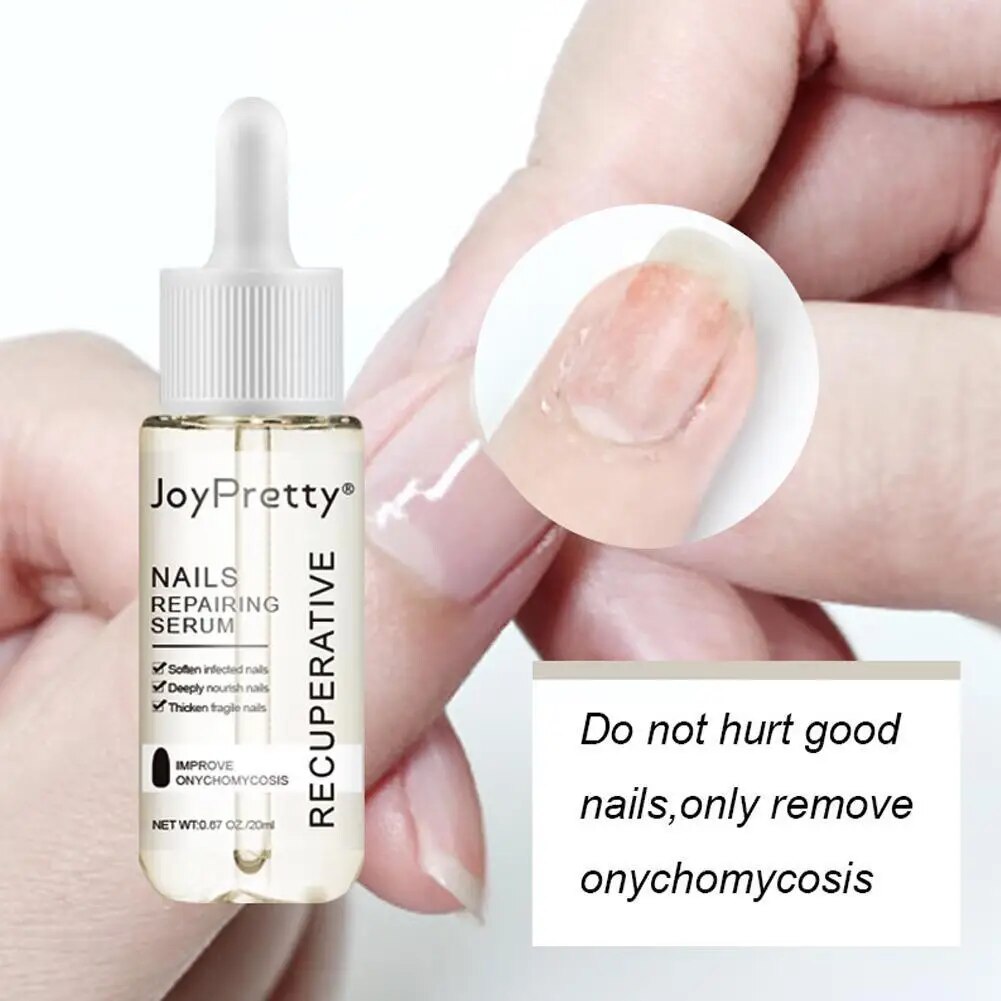 7 DAYS Repair Nail Fungus Treatments Essence Foot Care Fungal Nails Toe Removal Anti-Infection Onychomycosis Serum Gel Q0P8