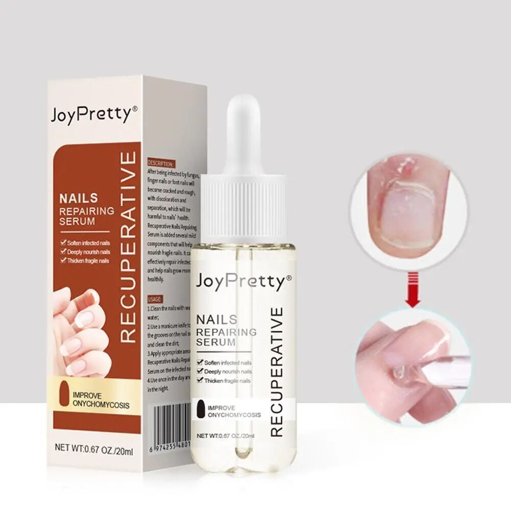 7 DAYS Repair Nail Fungus Treatments Essence Foot Care Fungal Nails Toe Removal Anti-Infection Onychomycosis Serum Gel Q0P8