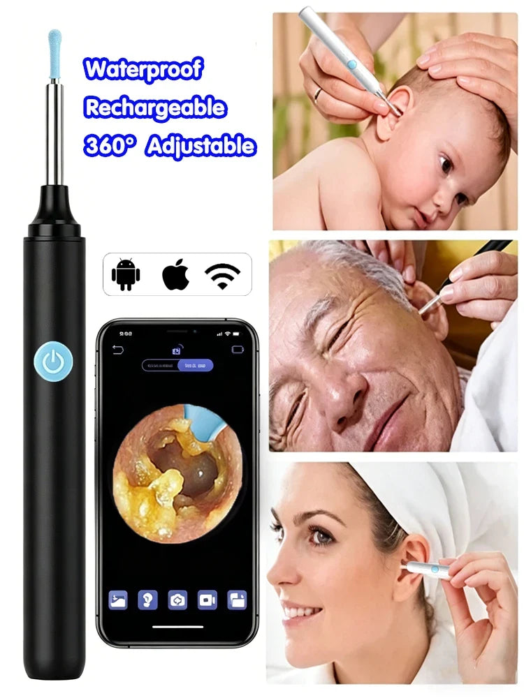 Multifunctional Ear Cleaner Camera 360°Adjustable Endoscope Ear Pick. USB-C Charging Ear Cleaner Family Ear Care Kit for Family