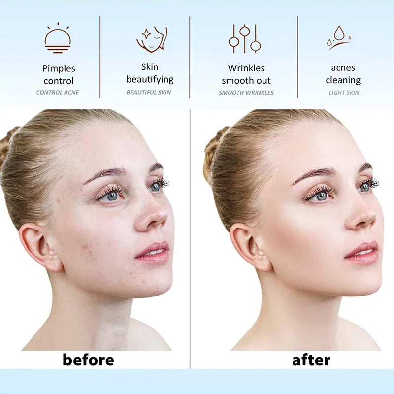 High Frequency Facial Machine Skin Therapy Electrode Wand Neon Electrotherapy Glass Tube Acne Spot Remover Face Skin Care Device
