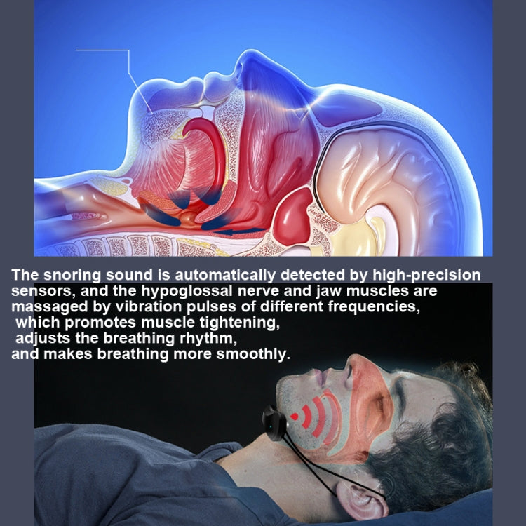 USB Rechargeable Smart Anti-snoring Device Home Snoring Corrector